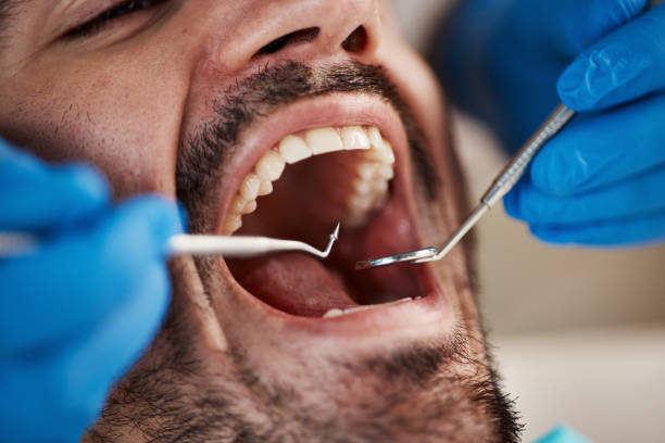Best Pediatric Emergency Dentist in Golden Hills, CA