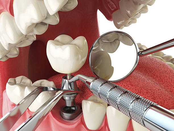 Best Emergency Treatment for Toothache in Golden Hills, CA