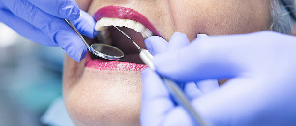 Best Emergency Wisdom Teeth Removal in Golden Hills, CA